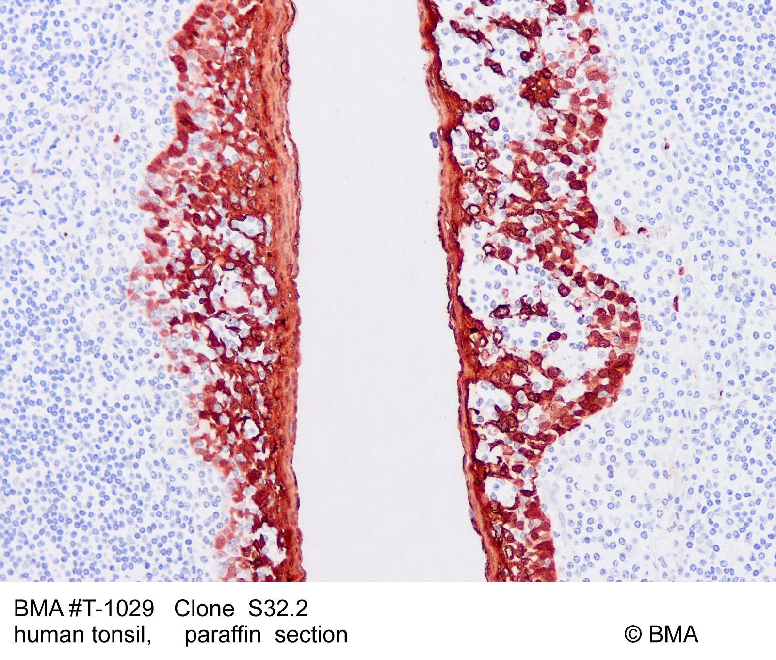 hp-t-1028_s32.2_human-tonsil_paraffin_0003.jpg