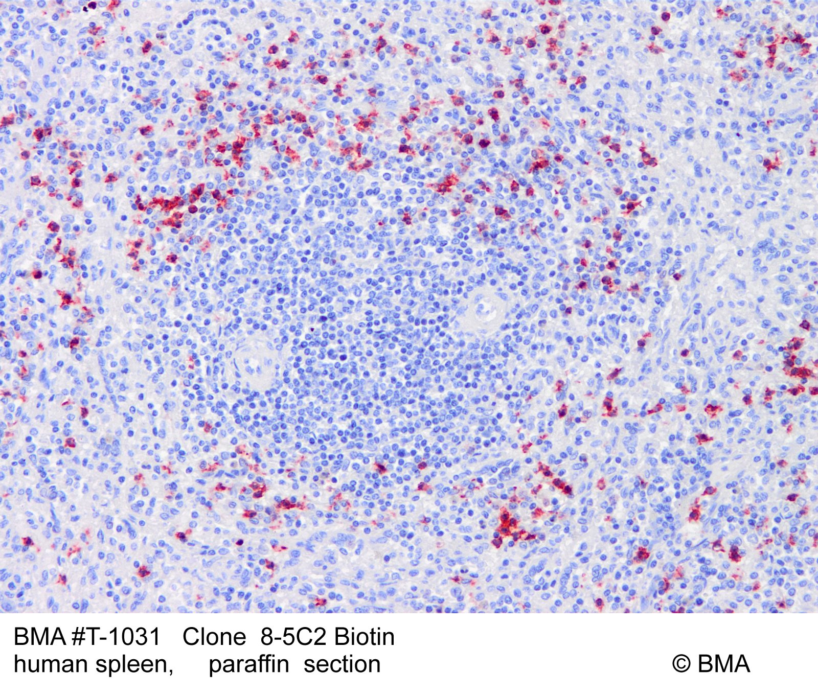 hp-t-1031_8-5c2-biotin_human-spleen_paraffin_0001.jpg