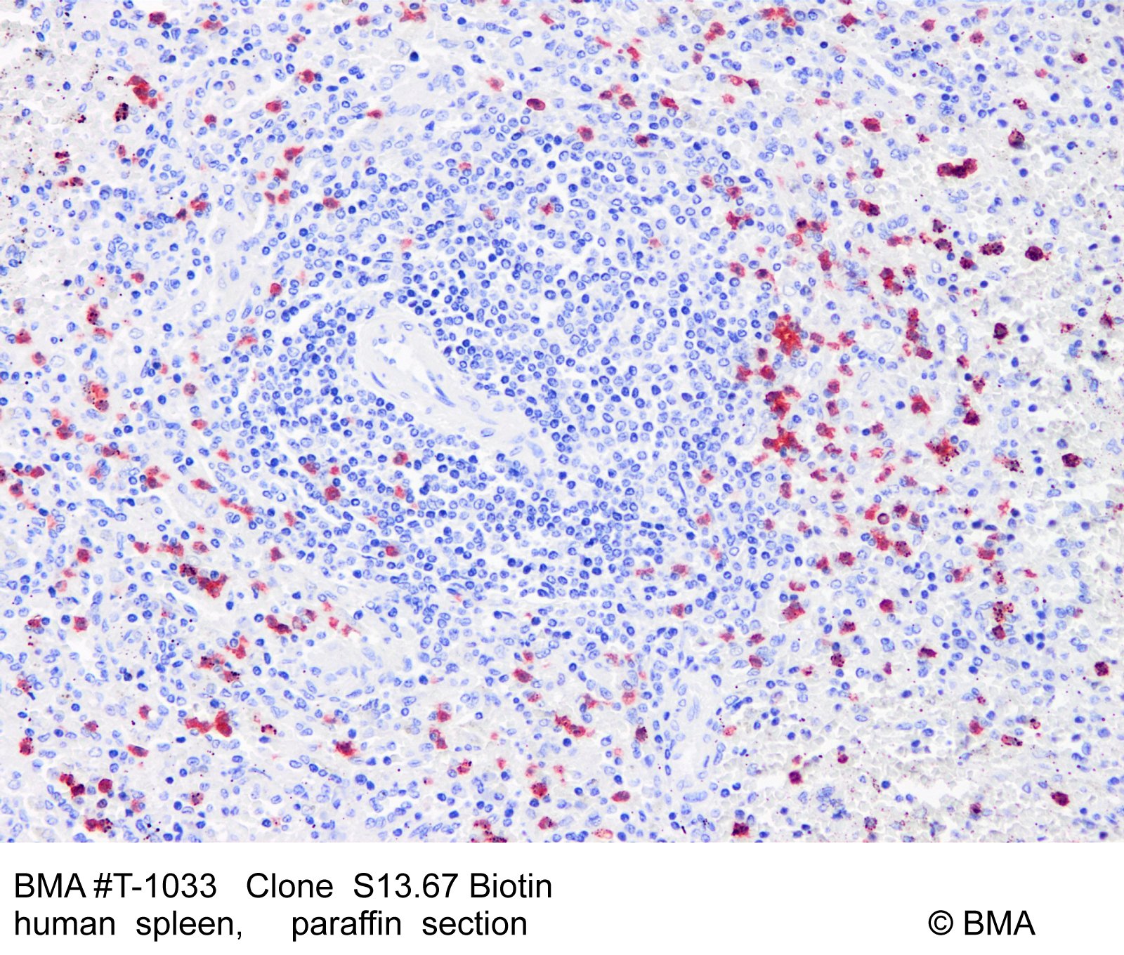 hp-t-1033_s13.67-biotin_human-spleen_paraffin_0001.jpg