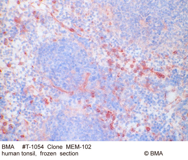 hp-t-1054_mem-102_tonsil-human_frozen_-0002.jpg