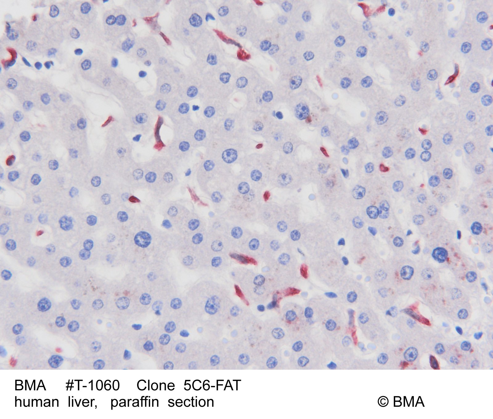 hp-t-1060_5c6-fat_human-liver-paraffin_-001.jpg