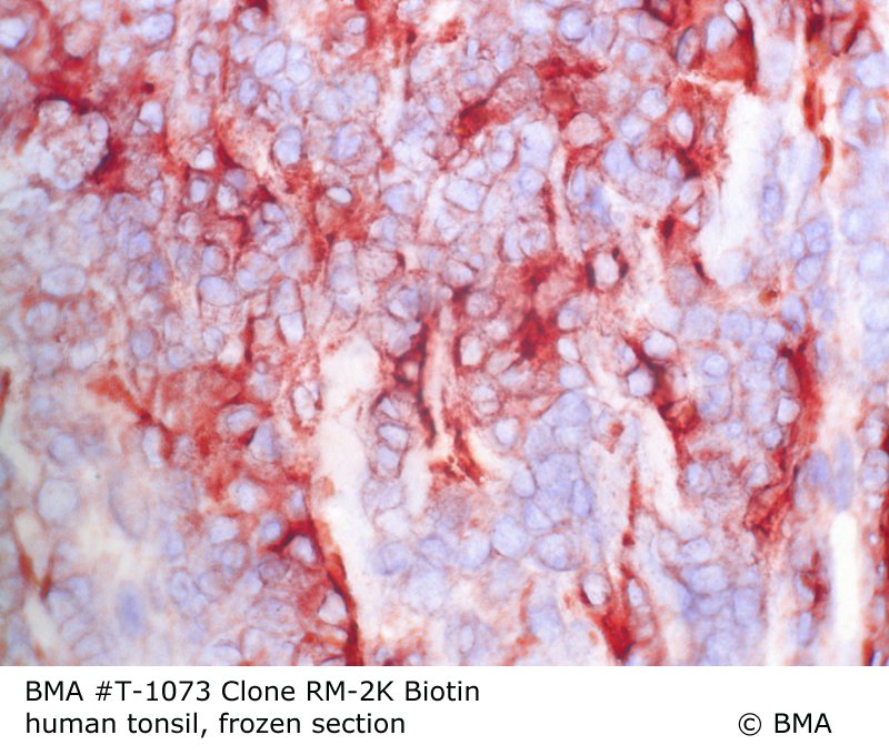 hp-t-1073_rm-2k-biotin_human-tonsil_frozen_0001.jpg