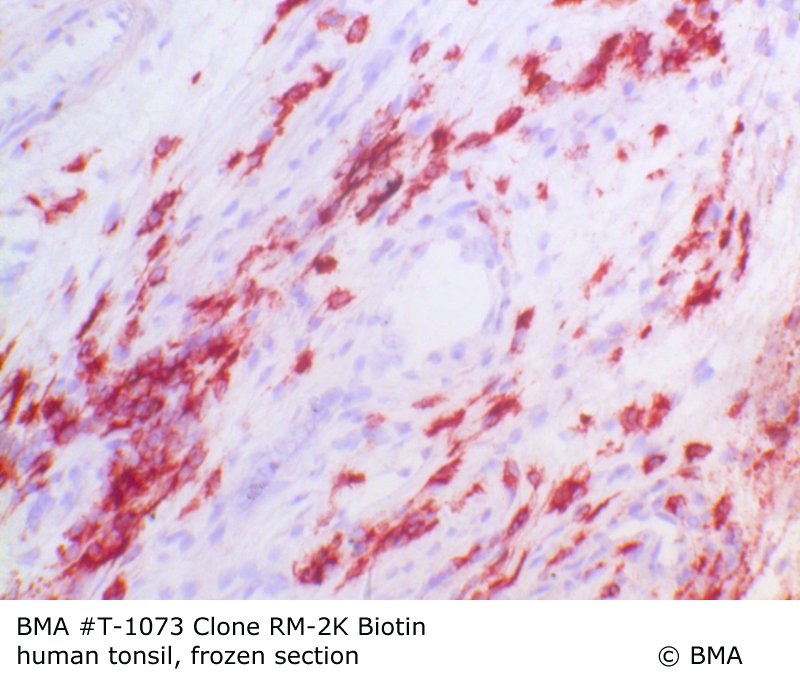 hp-t-1073_rm-2k-biotin_human-tonsil_frozen_0002.jpg
