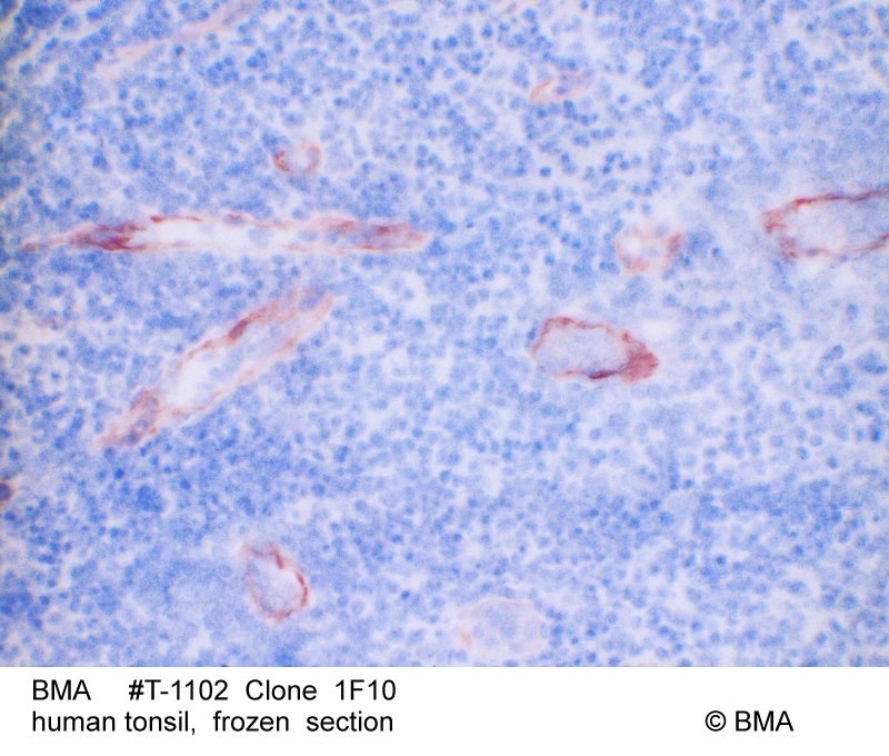 hp-t-1102_1f10_human-tonsil_frozen_0001.jpg
