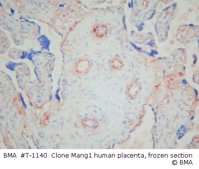 hp-t-1140-001_mang-1_human-placenta-frozen_-004.jpg