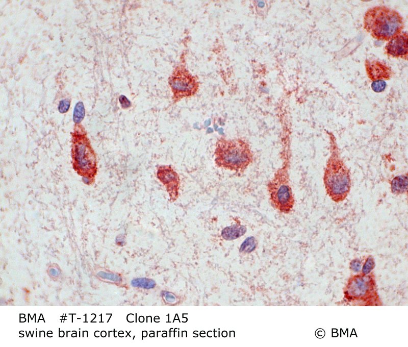 hp-t-1217_1a5_sw-brain-cortex_paraffin_prot.k._0003.jpg