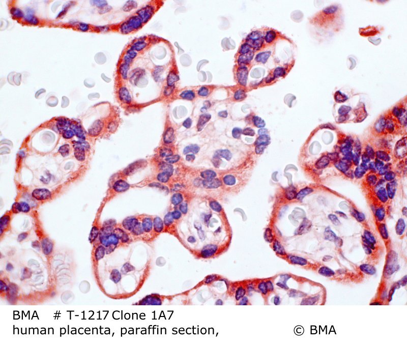 hp-t-1217_1a7_human-placenta_paraffin-prot.k.0003.jpg