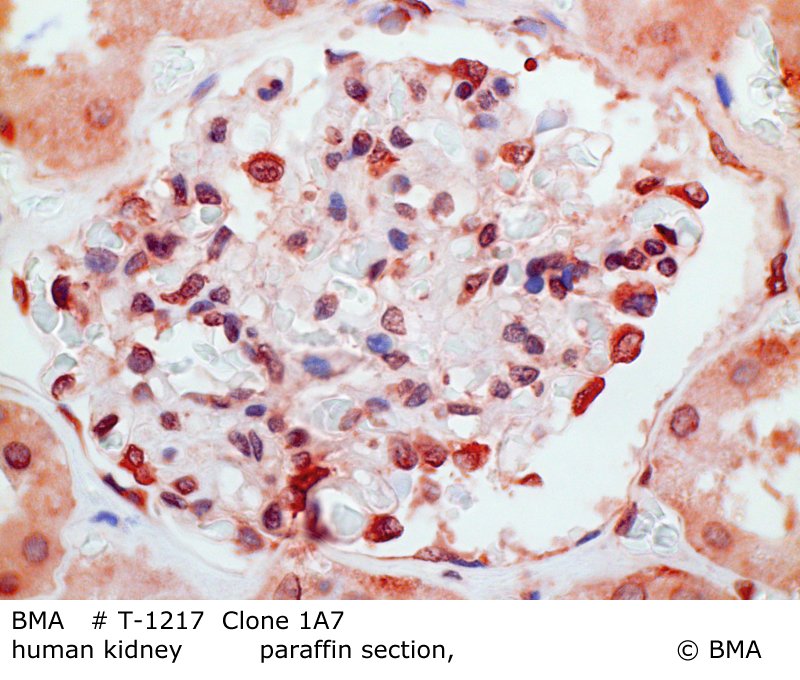 hp-t-1217_chemr23_igg2b_human-kidney_paraffin-prot.k.0002.jpg