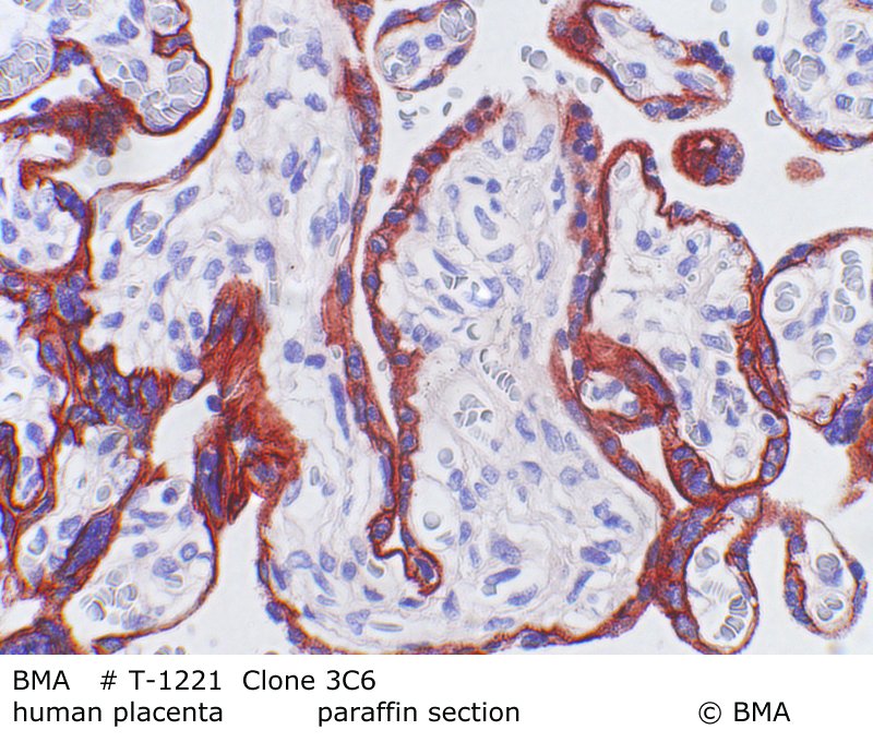 hp-t-1221_c5a_human-placenta_paraffin-prot.k_0002.jpg