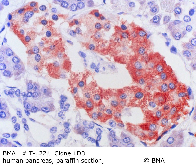 hp-t-1224_1d3__human-pancreas_paraffin-prot.k_0011.jpg