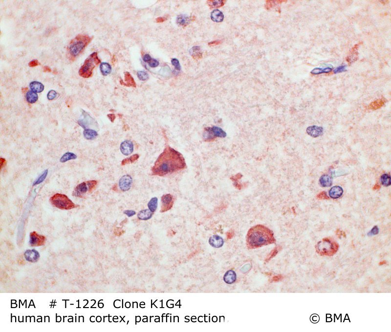 hp-t-1226_k1g4_human-brain-cortex_paraffin-prot.k_0001.jpg
