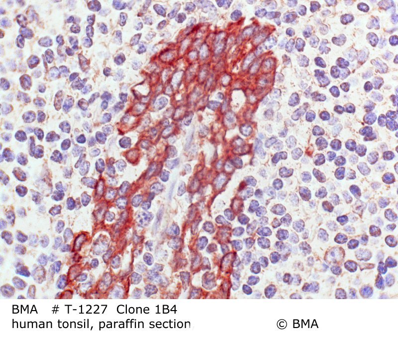 hp-t-1227_1b4_human-tonsil_paraffin-prot.k.0002.jpg