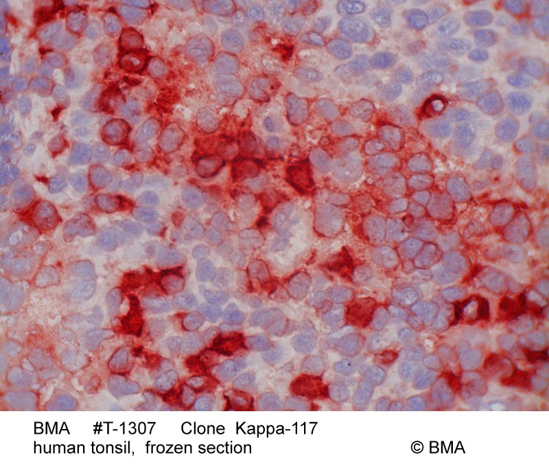 hp-t-1307_k-117_human-tonsil_frozen_0004.jpg