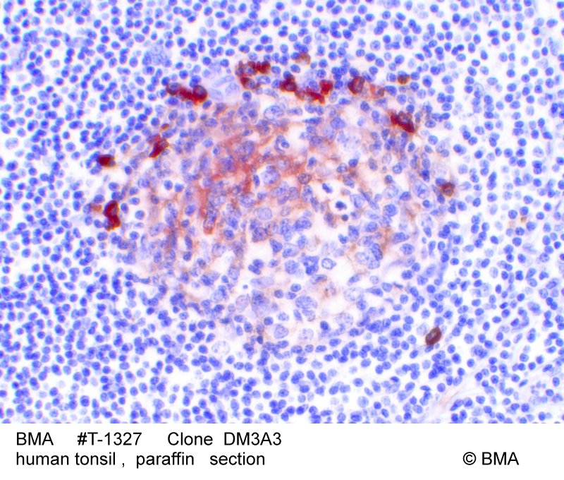 hp-t-1327_dm3a3_human-tonsil_paraffin_0001_1.jpg