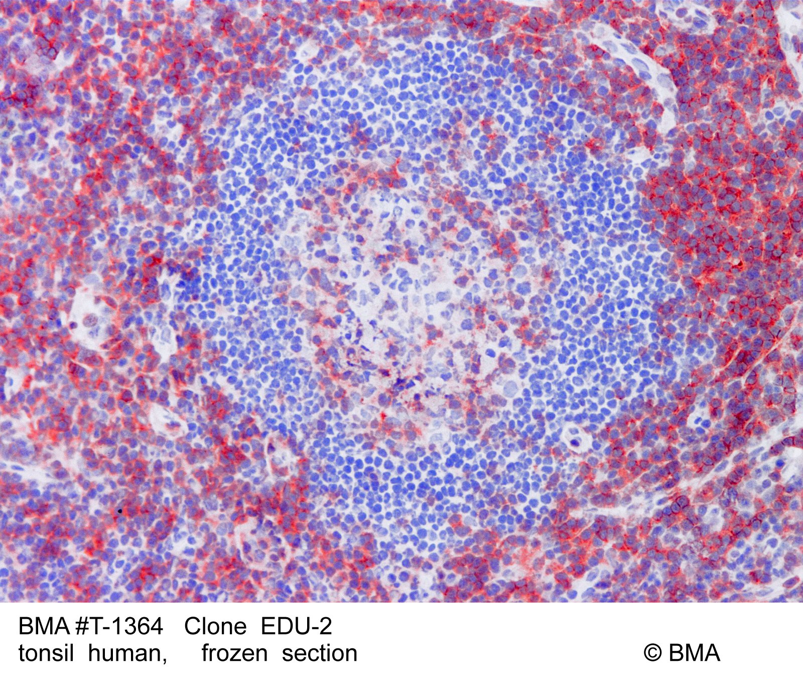 hp-t-1364_edu-2_human-tonsil_frozen_0001.jpg