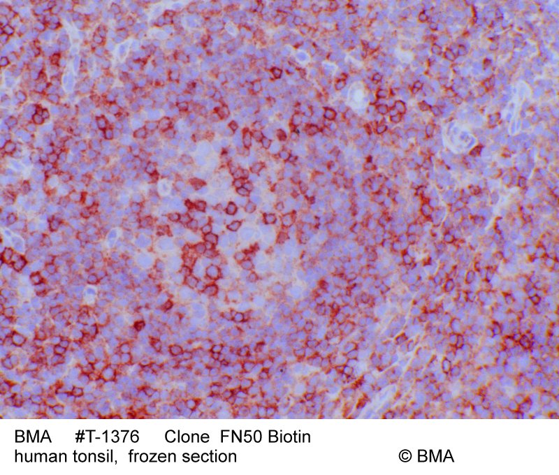 hp-t-1376_fn50_biotin_human-tonsil_frozen_0001.jpg