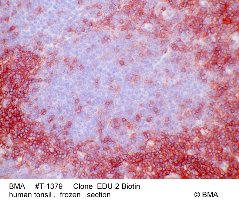 hp-t-1379_edu-2_biotin_human_tonsil_frozen_0004.jpg
