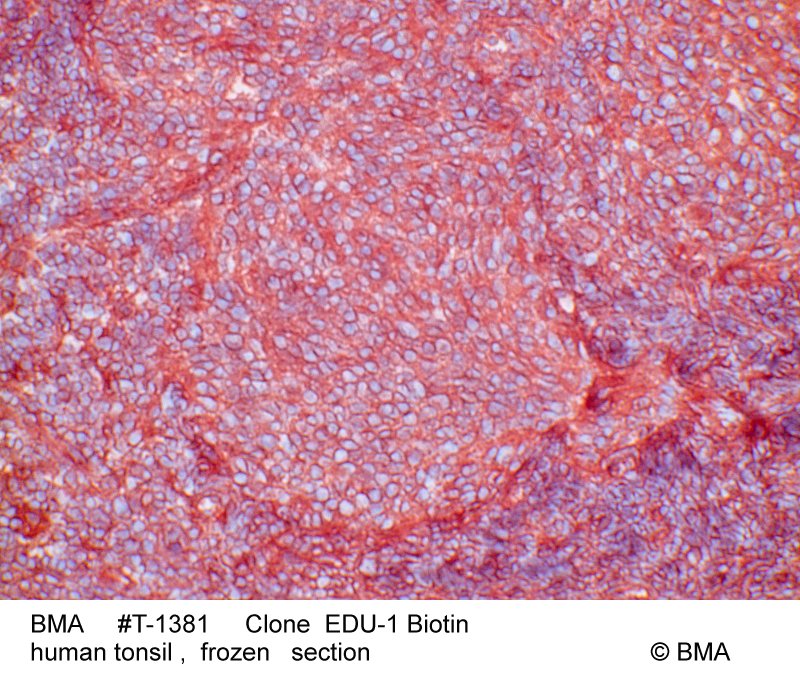 hp-t-1381_edu-1_biotin_human_tonsil_frozen_0002.jpg