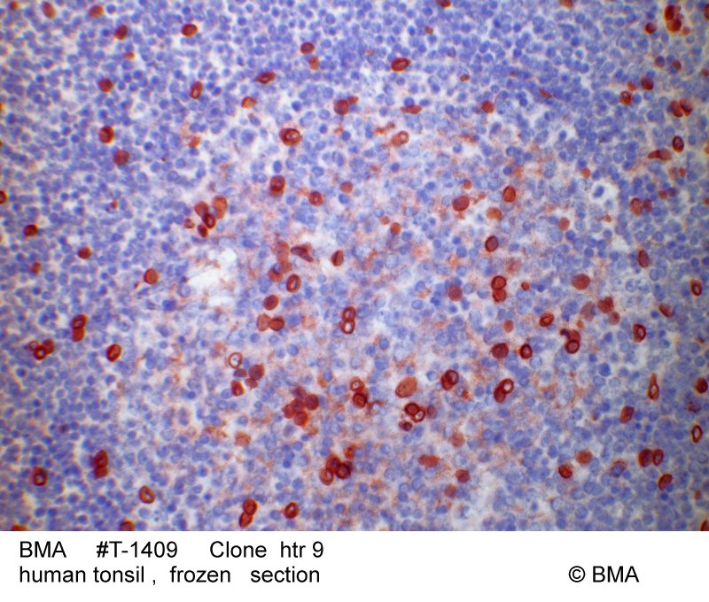 hp-t-1409_htr-9_human_tonsil_paraffin.jpg