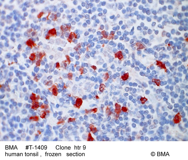 hp-t-1409_htr-9_human_tonsil_paraffin_0004.jpg