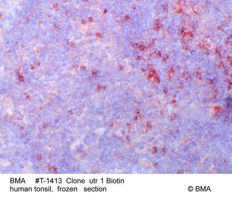 hp-t-1413_utr-1biotin_human_tonsil_frozen_0006.jpg