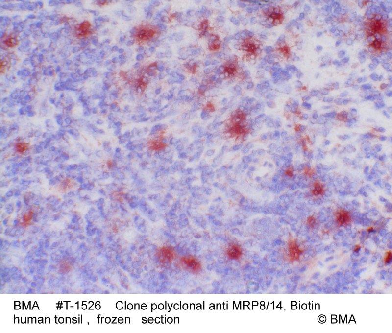 hp-t-1526_polyclonalmrp8-14_human_tonsil_paraffin_0002.jpg