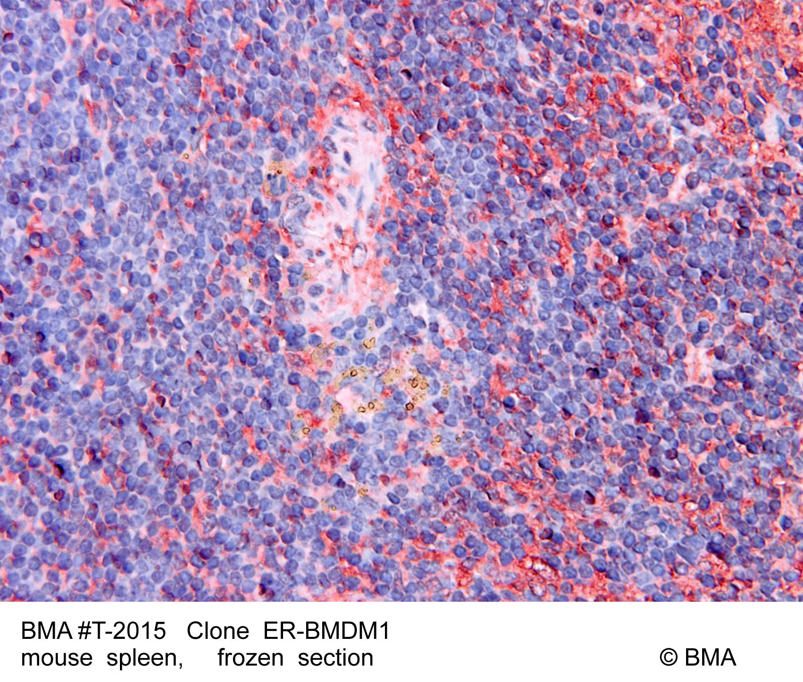hp-t-2015_er-bmdm1_mouse-spleen_paraffin_0001.jpg