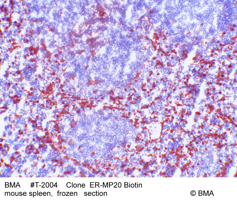 hp-t-2019_er-mp20biotin_mouse_spleen_frozen_0002.jpg