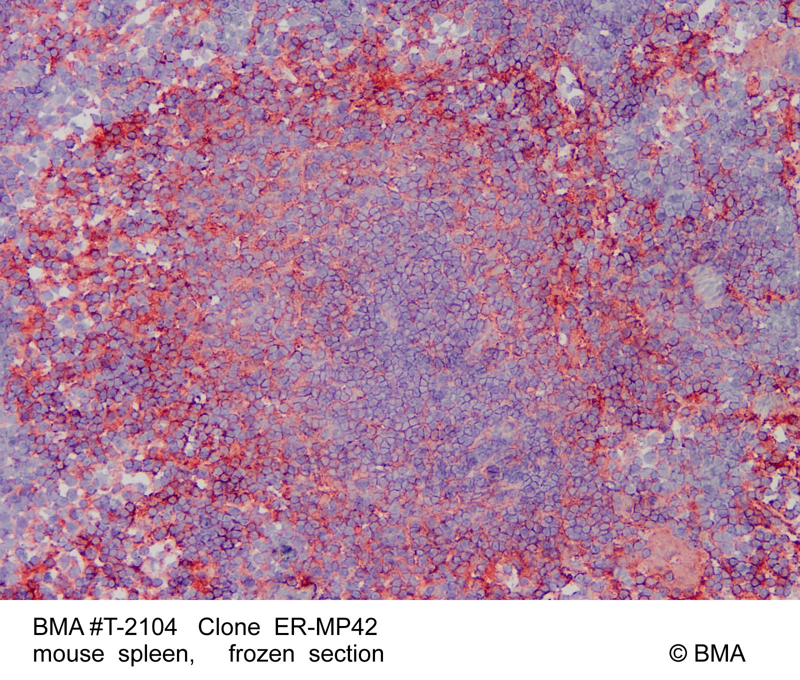 hp-t-2104_er-mp42_mouse-spleen_frozen_0004.jpg