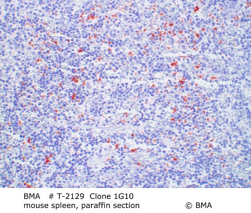 hp-t-2129_cmklr1_mouse-spleen_paraffin-prot.k_0001.jpg