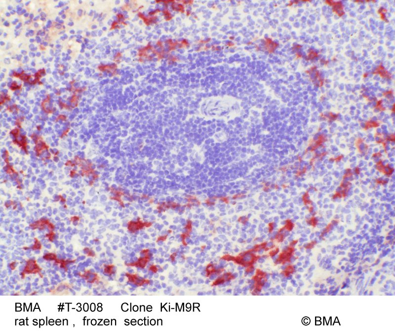 hp-t-3008_ki-m9r__rat-spleen_frozen_0006.jpg
