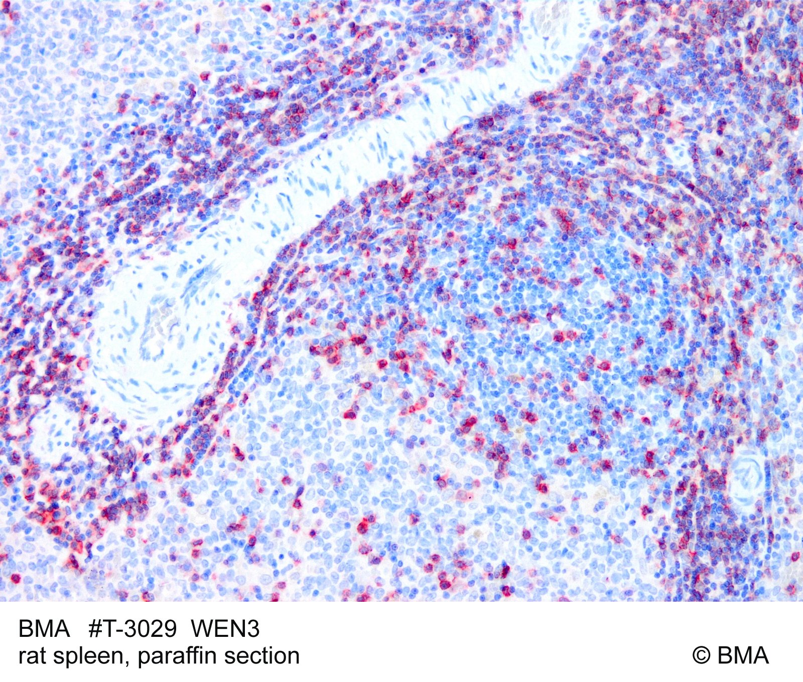 hp-t-3029_wen3_rat-spleen_-paraffin_mw_bild_188.jpg