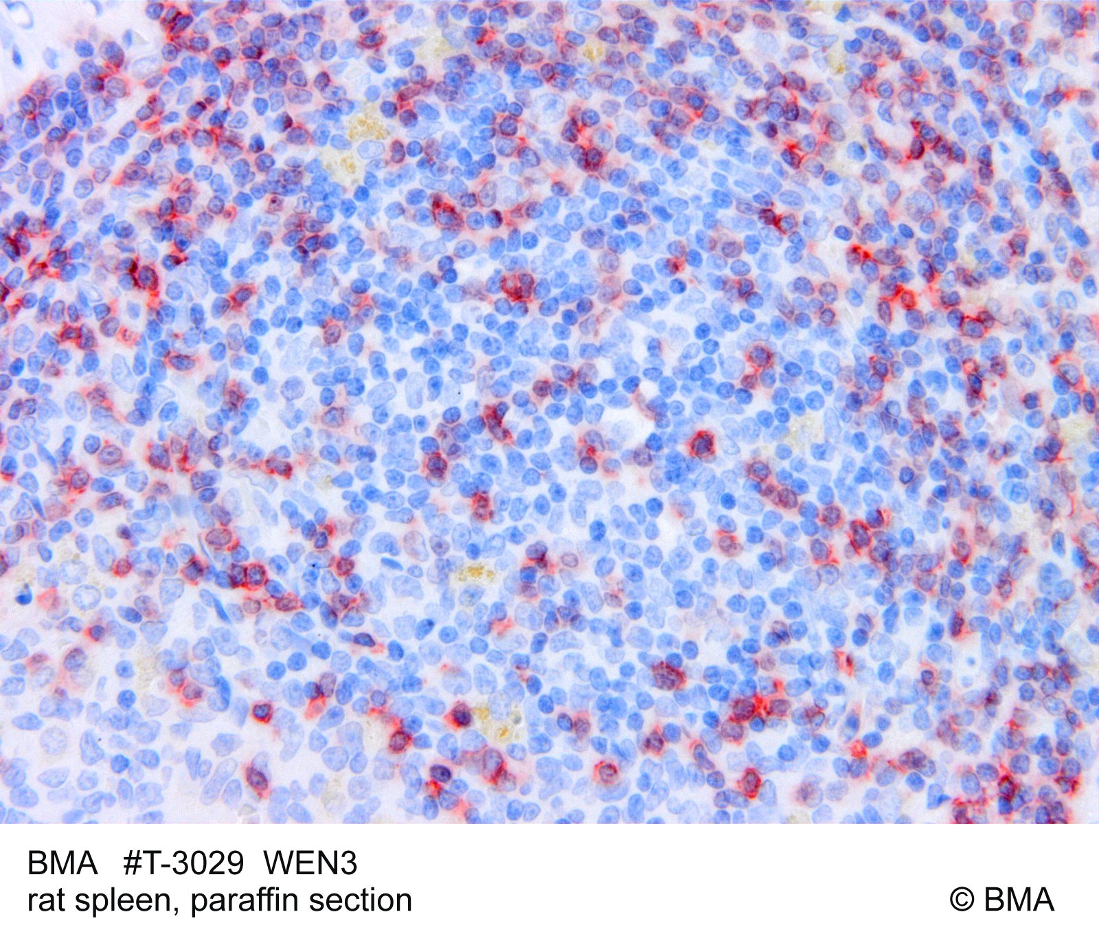 hp-t-3029_wen3_rat-spleen_-paraffin_mw_bild_189.jpg