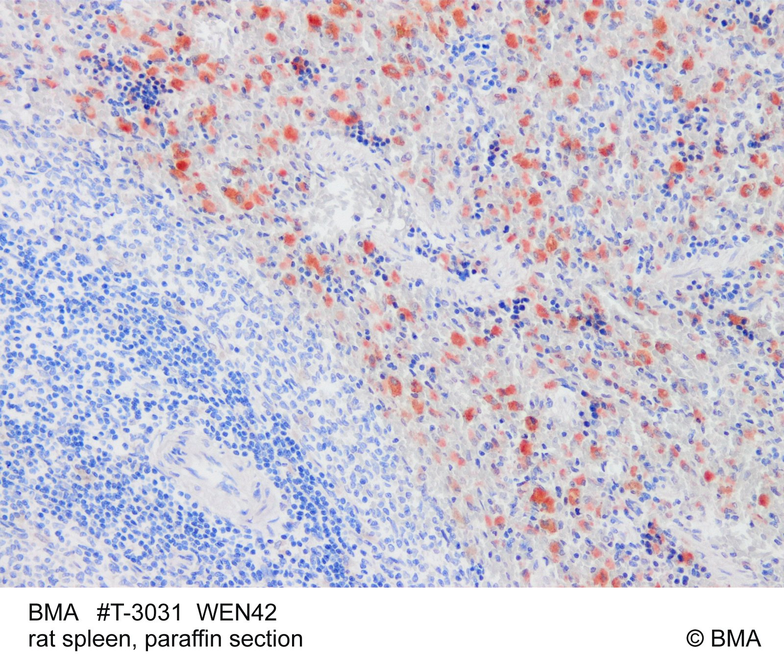 hp-t-3031_wen42_rat-spleen_-paraffin_mw_bild_205.jpg