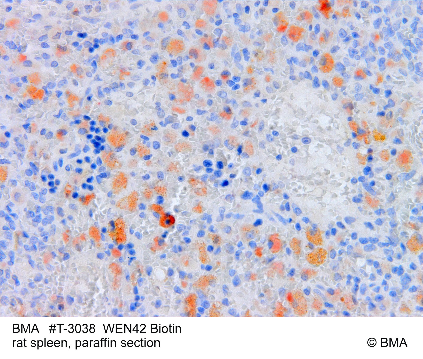 hp-t-3038_wen42_biotin_rat-spleen_-paraffin_mw_bild_210.jpg