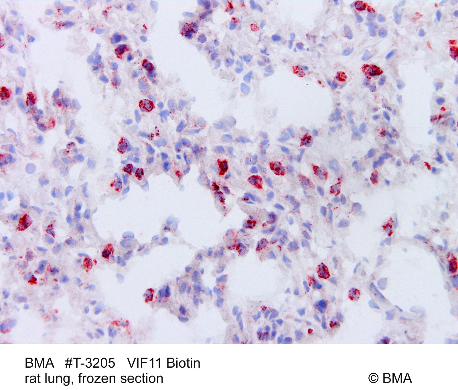 hp-t-3205_vif11biotin_rat-lung.jpg