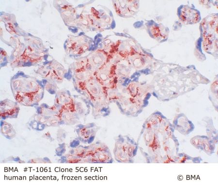 hp_t-1061_5c6_fat__human_placenta_frozen_0001.jpg