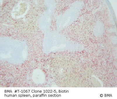 hp_t-1067_002_1022-5__biotin_human_spleen_paraffin.jpg