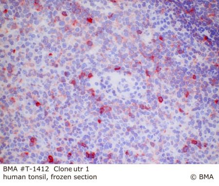 hp_t-1412_urt-1_human_tonsil_frozen_0001.jpg