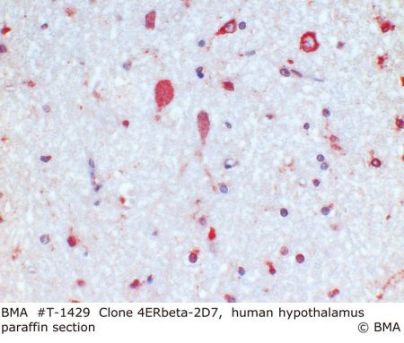 hp_t-1429_erb-2d7_human_hypotalamus_paraffin_0004.jpg