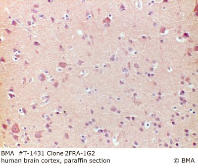 hp_t-1431_2fra-1g2__human_cortex_paraffin_0002.jpg