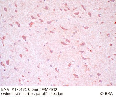 hp_t-1431_2fra-1g2__swine_cortex_paraffin_0002.jpg