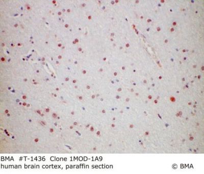 hp_t-1436_1mod-1a9_human_brain_cortex_paraffin_mw_.jpg