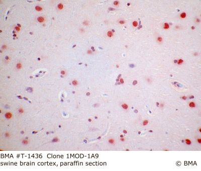 hp_t-1436_1mod-1a9_swine_brain_cortex_paraffin_mw_.jpg