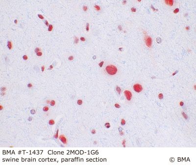 hp_t-1437_2mod-1g6_swine_cortex_paraffin_0001.jpg