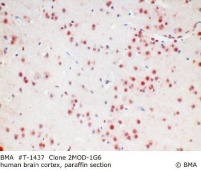 hp_t-1437_hp-1g6_human_brain_cortex_paraffin_mw_00.jpg
