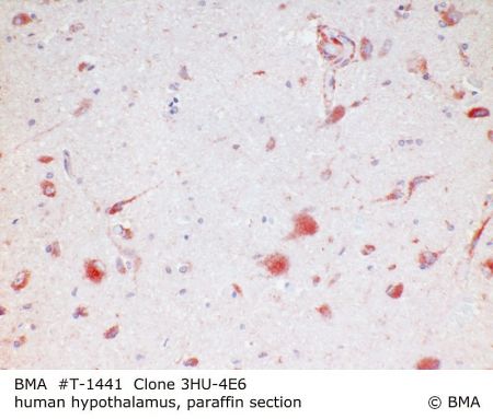 hp_t-1441_hu-4e6_human_hypothalamus_paraffin_0001.jpg