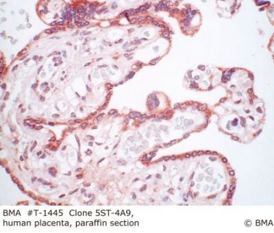 hp_t-1445_st-4a9_human_placenta_paraffin_prot.k_00.jpg