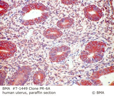 hp_t-1449_pr-6a_human_uterus_paraffin_0001.jpg