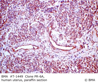 hp_t-1449_pr-6a_human_uterus_paraffin_prot.k_0002_.jpg